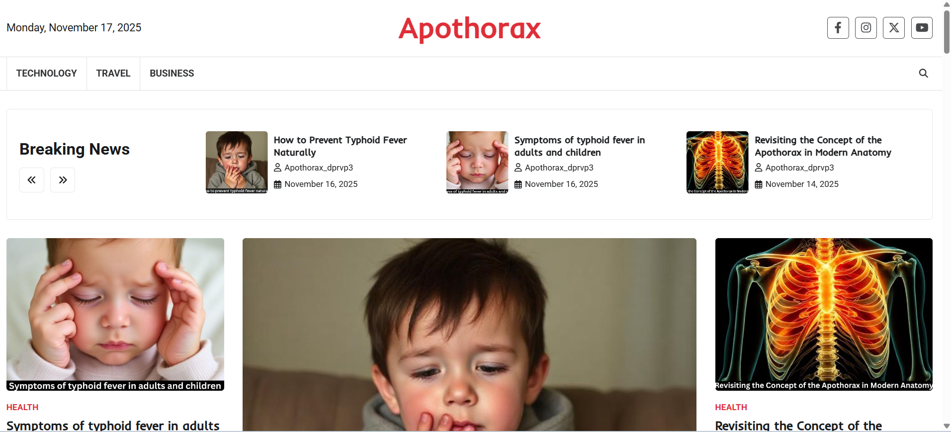 Why the Apothorax Matters: Heart, Lungs & Thoracic Protection